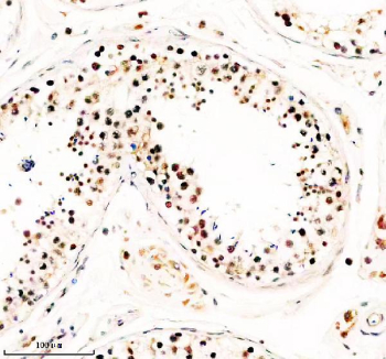 IHC analysis of TAF5 using anti-TAF5 antibody. TAF5 was detected in a paraffin-embedded section of human testis tissue. Heat mediated antigen retrieval was performed in EDTA buffer (pH 8.0, epitope retrieval solution). The tissue section was blocked with 10% goat serum. The tissue section was then incubated with 2 ug/ml rabbit anti-TAF5 antibody overnight at 4oC. Peroxidase Conjugated Goat Anti-rabbit IgG was used as secondary antibody and incubated for 30 minutes at 37oC. The tissue section was developed using an HRP secondary and DAB substrate.