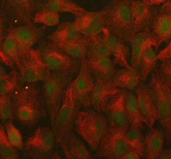 Immunofluorescent staining of RANBP9 using anti-RANBP9 antibody (green) and anti-Beta Tubulin antibody (red). RANBP9 was detected in immunocytochemical section of cell. Enzyme antigen retrieval was performed using IHC enzyme antigen retrieval reagent for 15 mins. The cells were blocked with 10% goat serum. And then incubated with 5 ug/ml rabbit anti-RANBP9 antibody and mouse anti-Beta Tubulin antibody overnight at 4oC. DyLight 488 Conjugated Goat Anti-Rabbit IgG and Cy3 Conjugated Goat Anti-Mouse IgG were used as secondary antibody at 1:500 dilution and incubated for 30 minutes at 37oC. The section was counterstained with DAPI (blue). Visualize using a fluorescence microscope and filter sets appropriate for the label used.
