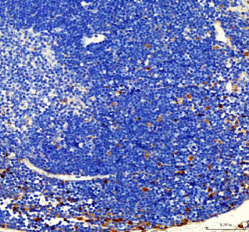 IHC analysis of FUBP1 using anti-FUBP1 antibody. FUBP1 was detected in a paraffin-embedded section of mouse spleen tissue. Heat mediated antigen retrieval was performed in EDTA buffer (pH 8.0, epitope retrieval solution). The tissue section was blocked with 10% goat serum. The tissue section was then incubated with 2 ug/ml rabbit anti-FUBP1 antibody overnight at 4oC. Peroxidase Conjugated Goat Anti-rabbit IgG was used as secondary antibody and incubated for 30 minutes at 37oC. The tissue section was developed using an HRP secondary and DAB substrate.