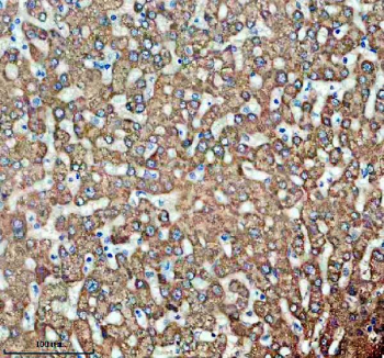Immunohistochemical staining of TIRAP using anti-TIRAP antibody. TIRAP was detected in a paraffin-embedded section of human liver tissue. Heat mediated antigen retrieval was performed in EDTA buffer (pH 8.0, epitope retrieval solution). The tissue section was blocked with 10% goat serum. The tissue section was then incubated with 2 ug/ml rabbit anti-TIRAP antibody overnight at 4oC. Peroxidase Conjugated Goat Anti-rabbit IgG was used as secondary antibody and incubated for 30 minutes at 37oC. The tissue section was developed using an HRP secondary and DAB substrate.