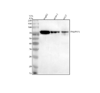Western blot analysis of PNLIPRP3 using anti-PNLIPRP3 antibody. Electrophoresis was performed on a 10% SDS-PAGE gel at 80V (Stacking gel) / 120V (Resolving gel) for 2 hours. Lane 1: human HepG2 whole cell lysates, Lane 2: human HUH-7 whole cell lysates, Lane 3: human HCCT whole cell lysates. After electrophoresis, proteins were transferred to a nitrocellulose membrane at 150 mA for 50-90 minutes. Blocked the membrane with 5% non-fat milk/TBS for 1.5 hour at RT. The membrane was incubated with rabbit anti-PNLIPRP3 antibody at 0.5 ug/ml overnight at 4oC, then washed with TBS-0.1%Tween 3 times with 5 minutes each and probed with a goat anti-rabbit IgG-HRP secondary antibody at a dilution of 1:5000 for 1.5 hour at RT. The signal was developed using an ECL Plus Western Blotting Substrate. The expected band size for PNLIPRP3 is at 52 kDa but may be observed at higher molecular weights due to glycosylation.