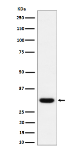 Western blot analysis of Adiponectin expression in human plasma lysate using ADIPOQ antibody.