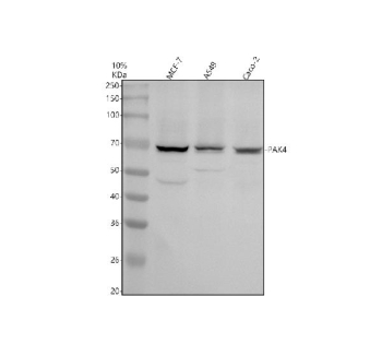 Western blot analysis of PAK4 using anti-PAK4 antibody. Electrophoresis was performed on a 10% SDS-PAGE gel at 80V (Stacking gel) / 120V (Resolving gel) for 2 hours. Lane 1: human MCF-7 whole cell lysates, Lane 2: human whole cell lysates, Lane 3: human Caco-2 whole cell lysates. After electrophoresis, proteins were transferred to a nitrocellulose membrane at 150 mA for 50-90 minutes. Blocked the membrane with 5% non-fat milk/TBS for 1.5 hour at RT. The membrane was incubated with rabbit anti-PAK4 antibody at 0.5 ug/ml overnight at 4oC, then washed with TBS-0.1%Tween 3 times with 5 minutes each and probed with a goat anti-rabbit IgG-HRP secondary antibody at a dilution of 1:5000 for 1.5 hour at RT. The signal was developed using an ECL Plus Western Blotting Substrate. A specific band was detected for PAK4 at approximately 64 kDa. The expected band size for PAK4 is at 64 kDa.