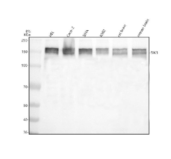 Western blot analysis of SIK3 using anti-SIK3 antibody. Electrophoresis was performed on a 8% SDS-PAGE gel at 80V (Stacking gel) / 120V (Resolving gel) for 2 hours. Lane 1: human HEL whole cell lysates, Lane 2: human Caco-2 whole cell lysates, Lane 3: human SIHA whole cell lysates, Lane 4: human K562 whole cell lysates, Lane 5: rat brain tissue lysates, Lane 6: mouse brain tissue lysates. After electrophoresis, proteins were transferred to a nitrocellulose membrane at 150 mA for 50-90 minutes. Blocked the membrane with 5% non-fat milk/TBS for 1.5 hour at RT. The membrane was incubated with rabbit anti-SIK3 antibody at 0.5 ug/ml overnight at 4oC, then washed with TBS-0.1%Tween 3 times with 5 minutes each and probed with a goat anti-rabbit IgG-HRP secondary antibody at a dilution of 1:5000 for 1.5 hour at RT. The signal was developed using an ECL Plus Western Blotting Substrate. The expected band size for SIK3 is at 145 kDa but is often observed as an ~150 kDa doublet representing differentially phosphorylated forms of SIK3 protein.