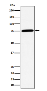Western blot analysis of PPM1G expression in Jurkat cell lysate using PPM1G antibody.
