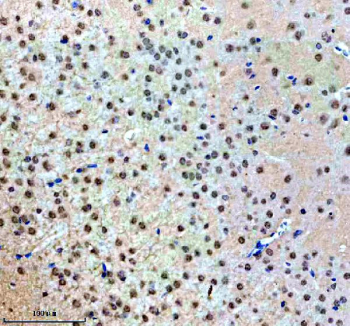Immunohistochemical staining of NUP93 using anti-NUP93 antibody. NUP93 was detected in a paraffin-embedded section of mouse brain tissue. Heat mediated antigen retrieval was performed in EDTA buffer (pH 8.0, epitope retrieval solution). The tissue section was blocked with 10% goat serum. The tissue section was then incubated with 2 ug/ml rabbit anti-NUP93 antibody overnight at 4oC. Peroxidase Conjugated Goat Anti-rabbit IgG was used as secondary antibody and incubated for 30 minutes at 37oC. The tissue section was developed using an HRP secondary and DAB substrate.