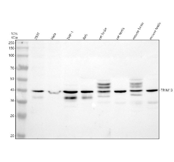 Western blot analysis of TRIM13 using anti-TRIM13 antibody. Electrophoresis was performed on a 10% SDS-PAGE gel at 80V (Stacking gel) / 120V (Resolving gel) for 2 hours. Lane 1: human 293T whole cell lysates, Lane 2: human Hela whole cell lysates, Lane 3: human THP-1 whole cell lysates, Lane 4: human REH whole cell lysates, Lane 5: rat brain tissue lysates, Lane 6: rat testis tissue lysates, Lane 7: mouse brain tissue lysates, Lane 8: mouse testis tissue lysates. After electrophoresis, proteins were transferred to a nitrocellulose membrane at 150 mA for 50-90 minutes. Blocked the membrane with 5% non-fat milk/TBS for 1.5 hour at RT. The membrane was incubated with rabbit anti-TRIM13 antibody at 0.5 ug/ml overnight at 4oC, then washed with TBS-0.1%Tween 3 times with 5 minutes each and probed with a goat anti-rabbit IgG-HRP secondary antibody at a dilution of 1:5000 for 1.5 hour at RT. The signal was developed using an ECL Plus Western Blotting Substrate. The expected band size for TRIM13 is at 47 kDa.