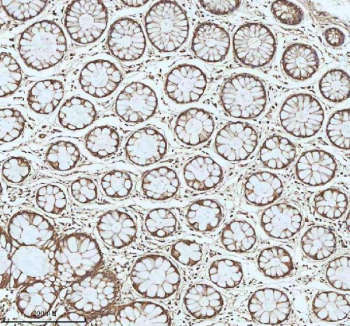 Immunohistochemical staining of MYH14 using anti-MYH14 antibody. MYH14 was detected in a paraffin-embedded section of human colon tissue. Heat mediated antigen retrieval was performed in EDTA buffer (pH 8.0, epitope retrieval solution). The tissue section was blocked with 10% goat serum. The tissue section was then incubated with 2 ug/ml rabbit anti-MYH14 antibody overnight at 4oC. Peroxidase Conjugated Goat Anti-rabbit IgG was used as secondary antibody and incubated for 30 minutes at 37oC. The tissue section was developed using an HRP secondary and DAB substrate.