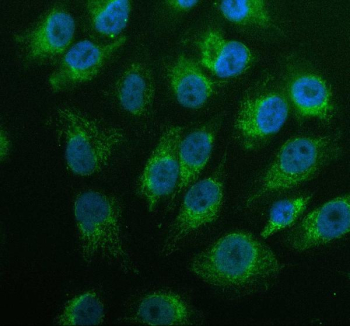 Immunofluorescent staining of GK2 using anti-GK2 antibody (green). GK2 was detected in an immunocytochemical section of cells. Enzyme antigen retrieval was performed using IHC enzyme antigen retrieval reagent for 15 mins. The cells were blocked with 10% goat serum. And then incubated with 5 ug/ml rabbit anti-GK2 antibody overnight at 4oC. DyLight 488 Conjugated Goat Anti-Rabbit IgG was used as secondary antibody at 1:500 dilution and incubated for 30 minutes at 37oC. The section was counterstained with DAPI nuclear stain (blue). Visualize using a fluorescence microscope and filter sets appropriate for the label used.