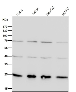 All lanes use the GRB2 antibody at 1:1K dilution for 1 hour at room temperature.