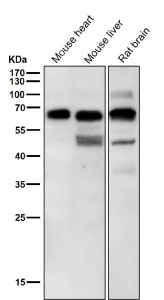 All lanes use the Phospho-p70 S6 Kinase beta (Ser371) antibody at 1:6K dilution for 1 hour at room temperature.