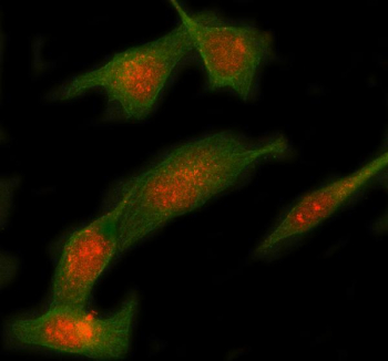 Immunofluorescent staining of STX12 using anti-STX12 antibody (red) and anti-Beta Tubulin antibody (green). STX12 was detected in immunocytochemical section of HELA cell. Enzyme antigen retrieval was performed using IHC enzyme antigen retrieval reagent for 15 mins. The cells were blocked with 10% goat serum. And then incubated with 5 ug/ml rabbit anti-STX12 antibody and mouse anti-Beta Tubulin antibody overnight at 4oC. Cy3 Conjugated Goat Anti-Rabbit IgG and FITC Conjugated Goat Anti-Mouse IgG were used as secondary antibody at 1:500 dilution and incubated for 30 minutes at 37oC. Visualize using a fluorescence microscope and filter sets appropriate for the label used.