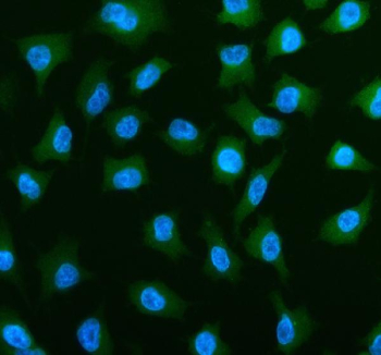 Immunofluorescent staining of PLS3 using anti-PLS3 antibody (green). PLS3 was detected in an immunocytochemical section of cells. Enzyme antigen retrieval was performed using IHC enzyme antigen retrieval reagent for 15 mins. The cells were blocked with 10% goat serum. And then incubated with 5 ug/ml rabbit anti-PLS3 antibody overnight at 4oC. DyLight 488 Conjugated Goat Anti-Rabbit IgG was used as secondary antibody at 1:500 dilution and incubated for 30 minutes at 37oC. The section was counterstained with DAPI nuclear stain (blue). Visualize using a fluorescence microscope and filter sets appropriate for the label used.