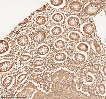 Immunohistochemical staining of NUP43 using anti-NUP43 antibody. NUP43 was detected in a paraffin-embedded section of human colon tissue. Heat mediated antigen retrieval was performed in EDTA buffer (pH 8.0, epitope retrieval solution). The tissue section was blocked with 10% goat serum. The tissue section was then incubated with 2 ug/ml rabbit anti-NUP43 antibody overnight at 4oC. Peroxidase Conjugated Goat Anti-rabbit IgG was used as secondary antibody and incubated for 30 minutes at 37oC. The tissue section was developed using an HRP secondary and DAB substrate.