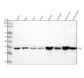 Western blot analysis of LIMS1 using anti-LIMS1 antibody. Lane 1: human Caco-2 whole cell lysates, Lane 2: human Hela whole cell lysates, Lane 3: human 293T whole cell lysates, Lane 4: human Jurkat whole cell lysates, Lane 5: rat lung tissue lysates, Lane 6: rat kidney tissue lysates, Lane 7: mouse lung tissue lysates, Lane 8: mouse kidney tissue lysates. After electrophoresis, proteins were transferred to a nitrocellulose membrane at 150 mA for 50-90 minutes. Blocked the membrane with 5% non-fat milk/TBS for 1.5 hour at RT. The membrane was incubated with rabbit anti-LIMS1 antibody at 0.5 ug/ml overnight at 4oC, then washed with TBS-0.1%Tween 3 times with 5 minutes each and probed with a goat anti-rabbit IgG-HRP secondary antibody at a dilution of 1:5000 for 1.5 hour at RT. The signal was developed using enhanced chemiluminescent. A specific band was detected for LIMS1 at approximately 37 kDa. The expected band size for LIMS1 is at 37 kDa.