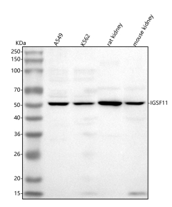 Western blot analysis of IGSF11 using anti-IGSF11 antibody. Lane 1: human whole cell lysates, Lane 2: human K562 whole cell lysates, Lane 3: rat kidney tissue lysates, Lane 4: mouse kidney tissue lysates. After electrophoresis, proteins were transferred to a nitrocellulose membrane at 150 mA for 50-90 minutes. Blocked the membrane with 5% non-fat milk/TBS for 1.5 hour at RT. The membrane was incubated with rabbit anti-IGSF11 antibody at 0.5 ug/ml overnight at 4oC, then washed with TBS-0.1%Tween 3 times with 5 minutes each and probed with a goat anti-rabbit IgG-HRP secondary antibody at a dilution of 1:5000 for 1.5 hour at RT. The signal was developed using enhanced chemiluminescent. A specific band was detected for IGSF11 at approximately 50 kDa. The expected band size for IGSF11 is at 46 kDa.