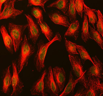 Immunofluorescent staining of MBTD1 using anti-MBTD1 antibody (green) and anti-Beta Tubulin antibody (red). MBTD1 was detected in immunocytochemical section of U2OS cell. Enzyme antigen retrieval was performed using IHC enzyme antigen retrieval reagent for 15 mins. The cells were blocked with 10% goat serum. And then incubated with 5 ug/ml rabbit anti-MBTD1 antibody and mouse anti-Beta Tubulin antibody overnight at 4oC. DyLight 488 Conjugated Goat Anti-Rabbit IgG and Cy3 Conjugated Goat Anti-Mouse IgG were used as secondary antibody at 1:500 dilution and incubated for 30 minutes at 37oC. Visualize using a fluorescence microscope and filter sets appropriate for the label used.