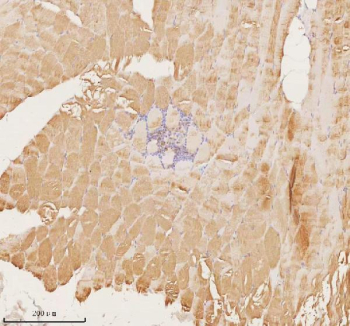 Immunohistochemical staining of MAP4K3 using anti-MAP4K3 antibody. MAP4K3 was detected in a paraffin-embedded section of human skeletal muscle tissue. Heat mediated antigen retrieval was performed in EDTA buffer (pH 8.0, epitope retrieval solution). The tissue section was blocked with 10% goat serum. The tissue section was then incubated with 2 ug/ml rabbit anti-MAP4K3 antibody overnight at 4oC. Peroxidase Conjugated Goat Anti-rabbit IgG was used as secondary antibody and incubated for 30 minutes at 37oC. The tissue section was developed using an HRP secondary and DAB substrate.