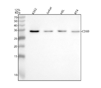 Western blot analysis of CD69 using anti-CD69 antibody. Lane 1: human K562 whole cell lysates, Lane 2: human Jurkat whole cell lysates, Lane 3: human HEL whole cell lysates, Lane 4: human RT4 whole cell lysates. After electrophoresis, proteins were transferred to a nitrocellulose membrane at 150 mA for 50-90 minutes. Blocked the membrane with 5% non-fat milk/TBS for 1.5 hour at RT. The membrane was incubated with rabbit anti-CD69 antibody at 0.5 ug/ml overnight at 4oC, then washed with TBS-0.1%Tween 3 times with 5 minutes each and probed with a goat anti-rabbit IgG-HRP secondary antibody at a dilution of 1:5000 for 1.5 hour at RT. The signal was developed using enhanced chemiluminescent. The expected band size for CD69 is at 23 kDa but may be observed at higher molecular weights due to glycosylation.