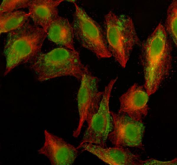 Immunofluorescent staining of PARG using anti-PARG antibody (green) and anti-Beta Tubulin antibody (red). PARG was detected in an immunocytochemical section of cells. Enzyme antigen retrieval was performed using IHC enzyme antigen retrieval reagent for 15 mins. The cells were blocked with 10% goat serum. And then incubated with 5 ug/ml rabbit anti-PARG antibody and mouse anti-Beta Tubulin antibody overnight at 4oC. DyLight 488 Conjugated Goat Anti-Rabbit IgG and Cy3 Conjugated Goat Anti-Mouse IgG were used as secondary antibody at 1:500 dilution and incubated for 30 minutes at 37oC. Visualize using a fluorescence microscope and filter sets appropriate for the label used.