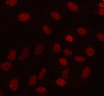 Immunofluorescent staining of MAMDC4 using anti-MAMDC4 antibody (red). MAMDC4 was detected in an immunocytochemical section of cells. Enzyme antigen retrieval was performed using IHC enzyme antigen retrieval reagent for 15 mins. The cells were blocked with 10% goat serum. And then incubated with 5 ug/ml rabbit anti-MAMDC4 antibody overnight at 4oC. Cy3 Conjugated Goat Anti-Rabbit IgG was used as secondary antibody at 1:500 dilution and incubated for 30 minutes at 37oC. Visualize using a fluorescence microscope and filter sets appropriate for the label used.