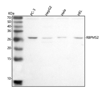 Western blot analysis of RBPMS2 using anti-RBPMS2 antibody. Lane 1: human PC-3 whole cell lysates, Lane 2: human HepG2 whole cell lysates, Lane 3: human Hela whole cell lysates, Lane 4: human HEL whole cell lysates. After electrophoresis, proteins were transferred to a nitrocellulose membrane at 150 mA for 50-90 minutes. Blocked the membrane with 5% non-fat milk/TBS for 1.5 hour at RT. The membrane was incubated with rabbit anti-RBPMS2 antibody at 0.5 ug/ml overnight at 4oC, then washed with TBS-0.1%Tween 3 times with 5 minutes each and probed with a goat anti-rabbit IgG-HRP secondary antibody at a dilution of 1:5000 for 1.5 hour at RT. The signal was developed using enhanced chemiluminescent. The expected molecular weight of RBPMS2 is ~22 kDa.