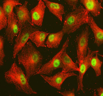 Immunofluorescent staining of POLD4 using anti-POLD4 antibody (green) and anti-Beta Tubulin antibody (red). POLD4 was detected in an immunocytochemical section of cells. Enzyme antigen retrieval was performed using IHC enzyme antigen retrieval reagent for 15 mins. The cells were blocked with 10% goat serum. And then incubated with 5 ug/ml rabbit anti-POLD4 antibody and mouse anti-Beta Tubulin antibody overnight at 4oC. DyLight 488 Conjugated Goat Anti-Rabbit IgG and Cy3 Conjugated Goat Anti-Mouse IgG were used as secondary antibody at 1:500 dilution and incubated for 30 minutes at 37oC. Visualize using a fluorescence microscope and filter sets appropriate for the label used.