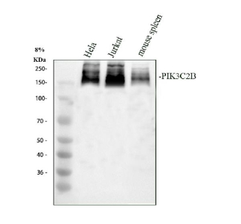 Western blot analysis of PIK3C2B using anti-PIK3C2B antibody. Electrophoresis was performed on a 8% SDS-PAGE gel at 80V (Stacking gel) / 120V (Resolving gel) for 2 hours. Lane 1: human placenta tissue lysates, Lane 2: mouse thymus tissue lysates. After electrophoresis, proteins were transferred to a nitrocellulose membrane at 150 mA for 50-90 minutes. Blocked the membrane with 5% non-fat milk/TBS for 1.5 hour at RT. The membrane was incubated with rabbit anti-PIK3C2B antibody at 0.5 ug/ml overnight at 4oC, then washed with TBS-0.1%Tween 3 times with 5 minutes each and probed with a goat anti-rabbit IgG-HRP secondary antibody at a dilution of 1:5000 for 1.5 hour at RT. The signal was developed using an ECL Plus Western Blotting Substrate. The dominant banding around ~160â180 kDa likely corresponds to fullâlength PIK3C2B with variable post-translational modification and possibly partial degradation or isoform heterogeneity.
