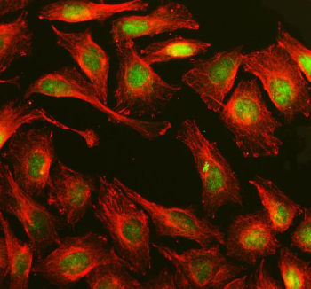Immunofluorescent staining of MPLKIP using anti-MPLKIP antibody (green) and anti-Beta Tubulin antibody (red). MPLKIP was detected in an immunocytochemical section of U2OS cells. Enzyme antigen retrieval was performed using IHC enzyme antigen retrieval reagent for 15 mins. The cells were blocked with 10% goat serum. And then incubated with 5 ug/ml rabbit anti-MPLKIP antibody and mouse anti-Beta Tubulin antibody overnight at 4oC. DyLight 488 Conjugated Goat Anti-Rabbit IgG and Cy3 Conjugated Goat Anti-Mouse IgG were used as secondary antibody at 1:500 dilution and incubated for 30 minutes at 37oC. Visualize using a fluorescence microscope and filter sets appropriate for the label used.