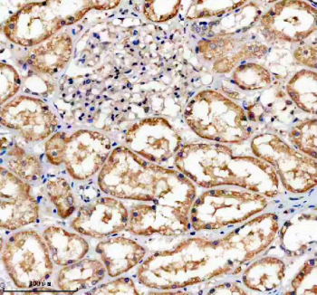 Immunohistochemical staining of TNFRSF10D using anti-TNFRSF10D antibody. TNFRSF10D was detected in a paraffin-embedded section of human kidney tissue. Heat mediated antigen retrieval was performed in EDTA buffer (pH 8.0, epitope retrieval solution). The tissue section was blocked with 10% goat serum. The tissue section was then incubated with 2 ug/ml rabbit anti-TNFRSF10D antibody overnight at 4oC. Peroxidase Conjugated Goat Anti-rabbit IgG was used as secondary antibody and incubated for 30 minutes at 37oC. The tissue section was developed using an HRP secondary and DAB substrate.