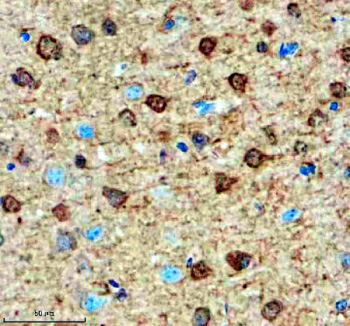 Immunohistochemical staining of SMARCAL1 using anti-SMARCAL1 antibody. SMARCAL1 was detected in a paraffin-embedded section of mouse brain tissue. Heat mediated antigen retrieval was performed in EDTA buffer (pH 8.0, epitope retrieval solution). The tissue section was blocked with 10% goat serum. The tissue section was then incubated with 2 ug/ml rabbit anti-SMARCAL1 antibody overnight at 4oC. Peroxidase Conjugated Goat Anti-rabbit IgG was used as secondary antibody and incubated for 30 minutes at 37oC. The tissue section was developed using an HRP secondary and DAB substrate.