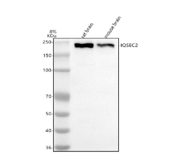 Western blot analysis of IQSEC2 using anti-IQSEC2 antibody. Electrophoresis was performed on a 8% SDS-PAGE gel at 80V (Stacking gel) / 120V (Resolving gel) for 2 hours. Lane 1: rat brain tissue lysates, Lane 2: mouse brain tissue lysates. After electrophoresis, proteins were transferred to a nitrocellulose membrane at 150 mA for 50-90 minutes. Blocked the membrane with 5% non-fat milk/TBS for 1.5 hour at RT. The membrane was incubated with rabbit anti-IQSEC2 antibody at 0.5 ug/ml overnight at 4oC, then washed with TBS-0.1%Tween 3 times with 5 minutes each and probed with a goat anti-rabbit IgG-HRP secondary antibody at a dilution of 1:5000 for 1.5 hour at RT. The signal was developed using an ECL Plus Western Blotting Substrate. IQSEC2 (~163 kDa predicted) was detected at ~200 kDa, consistent with the full-length, phosphorylated form reported in neuronal lysates.