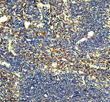 Immunohistochemical staining of Gp9 using anti-Gp9 antibody. Gp9 was detected in a paraffin-embedded section of mouse spleen tissue. Heat mediated antigen retrieval was performed in EDTA buffer (pH 8.0, epitope retrieval solution). The tissue section was blocked with 10% goat serum. The tissue section was then incubated with 2 ug/ml rabbit anti-Gp9 antibody overnight at 4oC. Peroxidase Conjugated Goat Anti-rabbit IgG was used as secondary antibody and incubated for 30 minutes at 37oC. The tissue section was developed using an HRP secondary and DAB substrate.