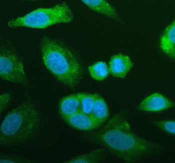 Immunofluorescent staining of FFPE human SiHa cells with NNMT antibody (green) and DAPI nuclear stain (blue). HIER: steam section in pH6 citrate buffer for 20 min.
