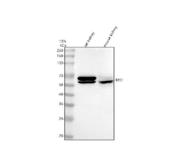 Western blot analysis of BBS1 using anti-BBS1 antibody. Lane 1: rat kidney tissue lysates, Lane 2: mouse kidney tissue lysates. After electrophoresis, proteins were transferred to a nitrocellulose membrane at 150 mA for 50-90 minutes. Blocked the membrane with 5% non-fat milk/TBS for 1.5 hour at RT. The membrane was incubated with rabbit anti-BBS1 antibody at 0.5 ug/ml overnight at 4oC, then washed with TBS-0.1%Tween 3 times with 5 minutes each and probed with a goat anti-rabbit IgG-HRP secondary antibody at a dilution of 1:5000 for 1.5 hour at RT. The signal was developed using enhanced chemiluminescent. BBS1 (~65 kDa predicted) was detected as bands at ~65 kDa and ~55 kDa. The higher band corresponds to the full-length, post-translationally modified BBSome-associated form, while the lower band likely represents a dephosphorylated or partially processed variant, consistent with published reports.