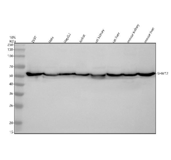 Western blot analysis of SHMT2 using anti-SHMT2 antibody. Electrophoresis was performed on a 10% SDS-PAGE gel at 80V (Stacking gel) / 120V (Resolving gel) for 2 hours. Lane 1: human 293T whole cell lysates, Lane 2: human Hela whole cell lysates, Lane 3: human HepG2 whole cell lysates, Lane 4: human Jurkat whole cell lysates, Lane 5: rat kidney tissue lysates, Lane 6: rat liver tissue lysates, Lane 7: mouse kidney tissue lysates, Lane 8: mouse liver tissue lysates. After electrophoresis, proteins were transferred to a nitrocellulose membrane at 150 mA for 50-90 minutes. Blocked the membrane with 5% non-fat milk/TBS for 1.5 hour at RT. The membrane was incubated with rabbit anti-SHMT2 antibody at 0.5 ug/ml overnight at 4oC, then washed with TBS-0.1%Tween 3 times with 5 minutes each and probed with a goat anti-rabbit IgG-HRP secondary antibody at a dilution of 1:5000 for 1.5 hour at RT. The signal was developed using an ECL Plus Western Blotting Substrate. The expected molecular weight of SHMT2 is ~56 kDa.
