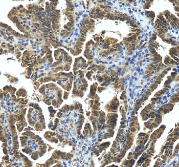 Strb Recommendation STRBP Antibody | FY12410 NSJ Bioreagents