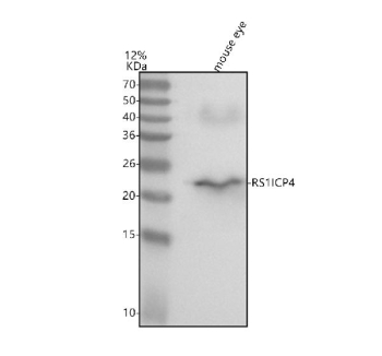 Western blot analysis of Retinoschisin using anti-Retinoschisin antibody. Lane 1: mouse eye tissue lysates. After electrophoresis, proteins were transferred to a nitrocellulose membrane at 150 mA for 50-90 minutes. Blocked the membrane with 5% non-fat milk/TBS for 1.5 hour at RT. The membrane was incubated with rabbit anti-Retinoschisin antibody at 0.5 ug/ml overnight at 4oC, then washed with TBS-0.1%Tween 3 times with 5 minutes each and probed with a goat anti-rabbit IgG-HRP secondary antibody at a dilution of 1:5000 for 1.5 hour at RT. The signal was developed using enhanced chemiluminescent. The expected molecular weight of RS1 is ~25 kDa.