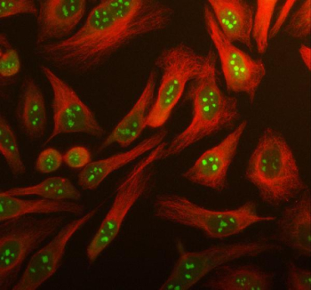 Immunofluorescent staining of using anti-ARL3 antibody (green) and anti-Beta Tubulin antibody (red). ARL3 was detected in an immunocytochemical section of human HeLa cells. Enzyme antigen retrieval was performed using IHC enzyme antigen retrieval reagent for 15 mins. The cells were blocked with 10% goat serum. And then incubated with 5 ug/ml rabbit anti-ARL3 antibody and mouse anti-Beta Tubulin antibody overnight at 4oC. DyLight 488 Conjugated Goat Anti-Rabbit IgG and Cy3 Conjugated Goat Anti-Mouse IgG were used as secondary antibody at 1:500 dilution and incubated for 30 minutes at 37oC. Visualize using a fluorescence microscope and filter sets appropriate for the label used.