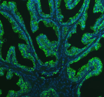 Immunofluorescent staining of BCAP29 using anti-BCAP29 antibody (green). BCAP29 was detected in a paraffin-embedded section of human prostate cancer tissue. Heat mediated antigen retrieval was performed in EDTA buffer (pH 8.0, epitope retrieval solution). The tissue section was blocked with 10% goat serum. The tissue section was then incubated with 5 ug/ml rabbit anti-BCAP29 antibody overnight at 4oC. DyLight 488 Conjugated Goat Anti-Rabbit IgG was used as secondary antibody at 1:500 dilution and incubated for 30 minutes at 37oC. The section was counterstained with DAPI nuclear stain (blue). Visualize using a fluorescence microscope and filter sets appropriate for the label used.