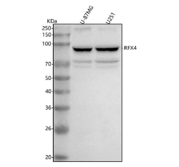 Western blot analysis of RFX4 using anti-RFX4 antibody. Lane 1: human U-87MG whole cell lysates, Lane 2: human U251 whole cell lysates. After electrophoresis, proteins were transferred to a nitrocellulose membrane at 150 mA for 50-90 minutes. Blocked the membrane with 5% non-fat milk/TBS for 1.5 hour at RT. The membrane was incubated with rabbit anti-RFX4 antibody at 0.5 ug/ml overnight at 4oC, then washed with TBS-0.1%Tween 3 times with 5 minutes each and probed with a goat anti-rabbit IgG-HRP secondary antibody at a dilution of 1:5000 for 1.5 hour at RT. The signal was developed using enhanced chemiluminescent. RFX4 (~83 kDa predicted) was detected as multiple bands between 70 and 120 kDa, consistent with reported alternative splice variants and proteolytic fragments of RFX4 in glioma and brain-derived cells.