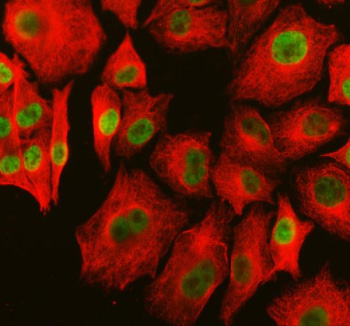 Immunofluorescent staining of PARP15 using anti-PARP15 antibody (green) and anti-Beta Tubulin antibody (red). PARP15 was detected in an immunocytochemical section of cells. Enzyme antigen retrieval was performed using IHC enzyme antigen retrieval reagent for 15 mins. The cells were blocked with 10% goat serum. And then incubated with 5 ug/ml rabbit anti-PARP15 antibody and mouse anti-Beta Tubulin antibody overnight at 4oC. DyLight 488 Conjugated Goat Anti-Rabbit IgG and Cy3 Conjugated Goat Anti-Mouse IgG were used as secondary antibody at 1:500 dilution and incubated for 30 minutes at 37oC. Visualize using a fluorescence microscope and filter sets appropriate for the label used.