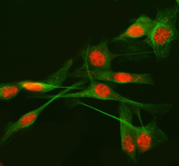 Immunofluorescent staining of METTL17 using anti-METTL17 antibody (red) and anti-Beta Tubulin antibody (green). METTL17 was detected in immunocytochemical section of HELA cell. Enzyme antigen retrieval was performed using IHC enzyme antigen retrieval reagent for 15 mins. The cells were blocked with 10% goat serum. And then incubated with 5 ug/ml rabbit anti-METTL17 antibody and mouse anti-Beta Tubulin antibody overnight at 4oC. Cy3 Conjugated Goat Anti-Rabbit IgG and DyLight 488 Conjugated Goat Anti-Mouse IgG were used as secondary antibody at 1:500 dilution and incubated for 30 minutes at 37oC. Visualize using a fluorescence microscope and filter sets appropriate for the label used.