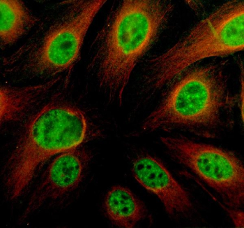 Immunofluorescent staining of TRIM11 using anti-TRIM11 antibody (green) and anti-Alpha Tubulin antibody (red). TRIM11 was detected in an immunocytochemical section of HELA cells. Enzyme antigen retrieval was performed using IHC enzyme antigen retrieval reagent for 15 mins. The cells were blocked with 10% goat serum. And then incubated with 5 ug/ml rabbit anti-TRIM11 antibody and mouse anti-Beta Tubulin antibody overnight at 4oC. DyLight 488 Conjugated Goat Anti-Rabbit IgG and Cy3 Conjugated Goat Anti-Mouse IgG were used as secondary antibody at 1:500 dilution and incubated for 30 minutes at 37oC. Visualize using a fluorescence microscope and filter sets appropriate for the label used.