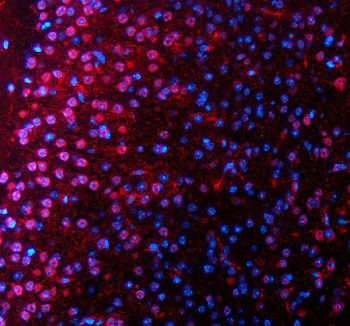 Immunofluorescent staining of SALL2 using anti-SALL2 antibody (red)). SALL2 was detected in a paraffin-embedded section of mouse brain tissue. Heat mediated antigen retrieval was performed in EDTA buffer (pH 8.0, epitope retrieval solution). The tissue section was blocked with 10% goat serum. The tissue section was then incubated with 5 ug/ml rabbit anti-SALL2 antibody overnight at 4oC. Cy3 Conjugated Goat Anti-Rabbit IgG was used as secondary antibody at 1:500 dilution and incubated for 30 minutes at 37oC. The section was counterstained with DAPI nuclear stain (blue). Visualize using a fluorescence microscope and filter sets appropriate for the label used.