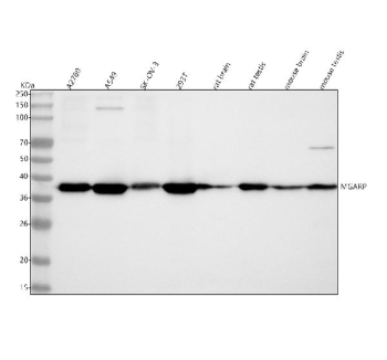 Western blot analysis of C4orf49/MGARP using anti-MGARP antibody. Lane 1: human whole cell lysates, Lane 2: human whole cell lysates, Lane 3: human SK-OV-3 whole cell lysates, Lane 4: human 293T whole cell lysates, Lane 5: rat brain tissue lysates, Lane 6: rat testis tissue lysates, Lane 7: mouse brain tissue lysates, Lane 8: mouse testis tissue lysates. After electrophoresis, proteins were transferred to a nitrocellulose membrane at 150 mA for 50-90 minutes. Blocked the membrane with 5% non-fat milk/TBS for 1.5 hour at RT. The membrane was incubated with rabbit anti-MGARP antibody at 0.25 ug/ml overnight at 4oC, then washed with TBS-0.1%Tween 3 times with 5 minutes each and probed with a goat anti-rabbit IgG-HRP secondary antibody at a dilution of 1:5000 for 1.5 hour at RT. The signal was developed using enhanced chemiluminescent. MGARP (~25 kDa predicted) was detected at ~38 kDa, consistent with anomalously slow SDS-PAGE migration of this glutamic-acidârich, intrinsically disordered mitochondrial transmembrane protein.