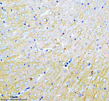 Immunohistochemical staining of MARCKS using anti-MARCKS antibody. MARCKS was detected in a paraffin-embedded section of mouse brain tissue. Heat mediated antigen retrieval was performed in EDTA buffer (pH 8.0, epitope retrieval solution). The tissue section was blocked with 10% goat serum. The tissue section was then incubated with 2 ug/ml rabbit anti-MARCKS antibody overnight at 4oC. Peroxidase Conjugated Goat Anti-rabbit IgG was used as secondary antibody and incubated for 30 minutes at 37oC. The tissue section was developed using an HRP secondary and DAB substrate.