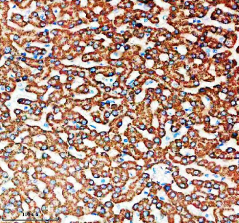 Immunohistochemical staining of SNX16 using anti-SNX16 antibody. SNX16 was detected in a paraffin-embedded section of human liver tissue. Heat mediated antigen retrieval was performed in EDTA buffer (pH 8.0, epitope retrieval solution). The tissue section was blocked with 10% goat serum. The tissue section was then incubated with 2 ug/ml rabbit anti-SNX16 antibody overnight at 4oC. Peroxidase Conjugated Goat Anti-rabbit IgG was used as secondary antibody and incubated for 30 minutes at 37oC. The tissue section was developed using an HRP secondary and DAB substrate.