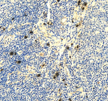 Immunohistochemical staining of RNF111 using anti-RNF111 antibody. RNF111 was detected in a paraffin-embedded section of human tonsil tissue. Heat mediated antigen retrieval was performed in EDTA buffer (pH 8.0, epitope retrieval solution). The tissue section was blocked with 10% goat serum. The tissue section was then incubated with 2 ug/ml rabbit anti-RNF111 antibody overnight at 4oC. Peroxidase Conjugated Goat Anti-rabbit IgG was used as secondary antibody and incubated for 30 minutes at 37oC. The tissue section was developed using an HRP secondary and DAB substrate.