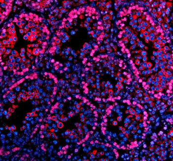 Immunofluorescent staining of PARP11 using anti-PARP11 antibody (red). PARP11 was detected in a paraffin-embedded section of mouse testis tissue. Heat mediated antigen retrieval was performed in EDTA buffer (pH 8.0, epitope retrieval solution). The tissue section was blocked with 10% goat serum. The tissue section was then incubated with 5 ug/ml rabbit anti-PARP11 antibody overnight at 4oC. Cy3 Conjugated Goat Anti-Rabbit IgG was used as secondary antibody at 1:500 dilution and incubated for 30 minutes at 37oC. The section was counterstained with DAPI nuclear stain (blue). Visualize using a fluorescence microscope and filter sets appropriate for the label used.
